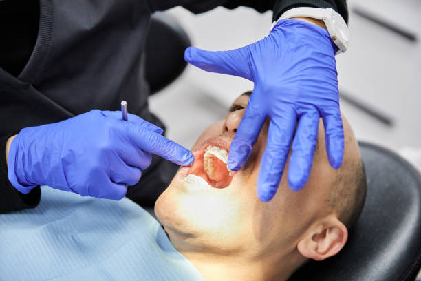 Best Emergency Treatment for Dental Infections or Abscesses in Mahopac, NY