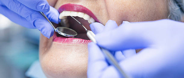 Best Emergency Gum Treatment in Mahopac, NY